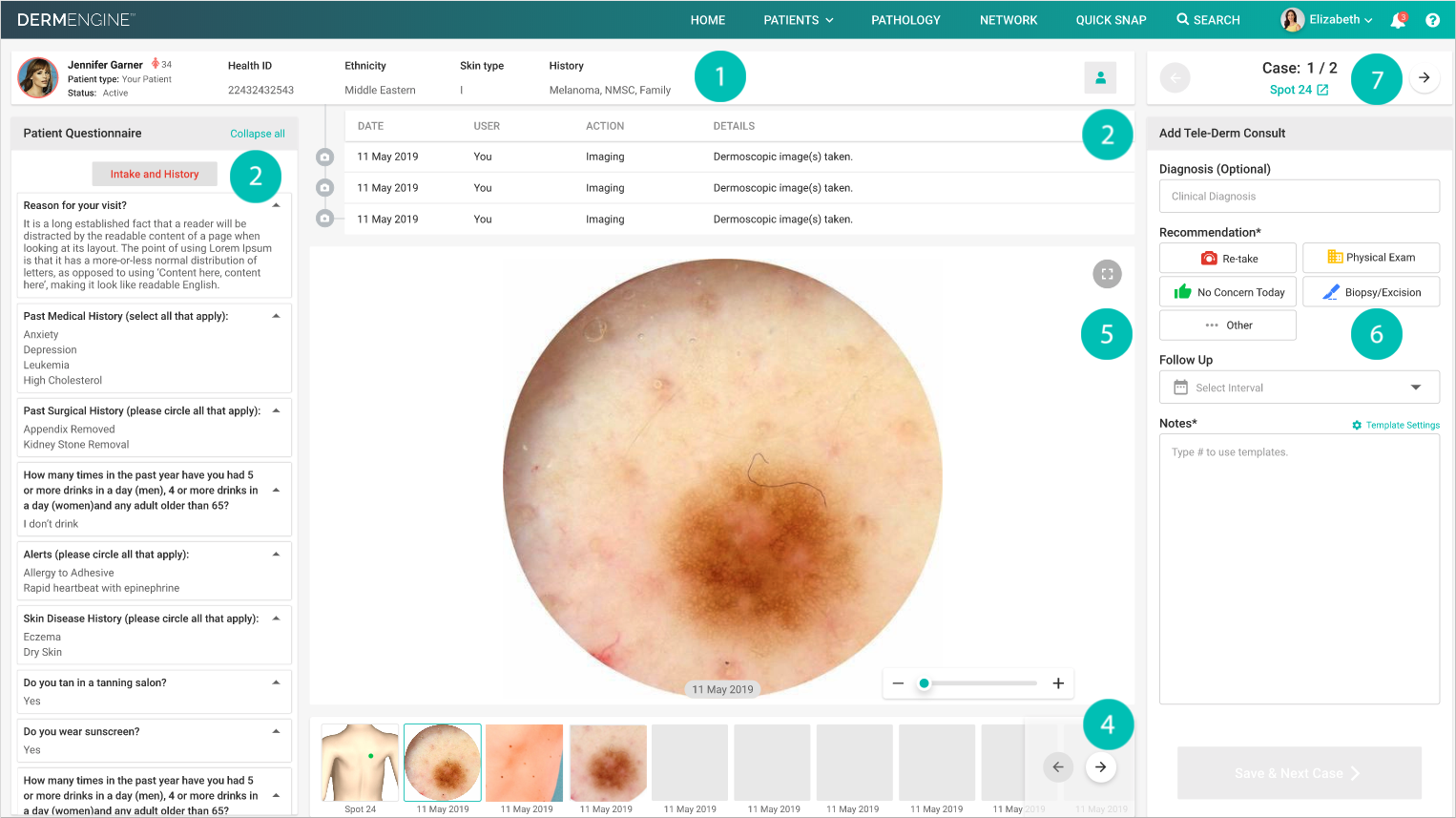 New Teledermatology Panel